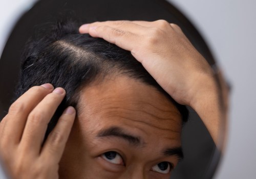 Can poor nutrition cause hair thinning?